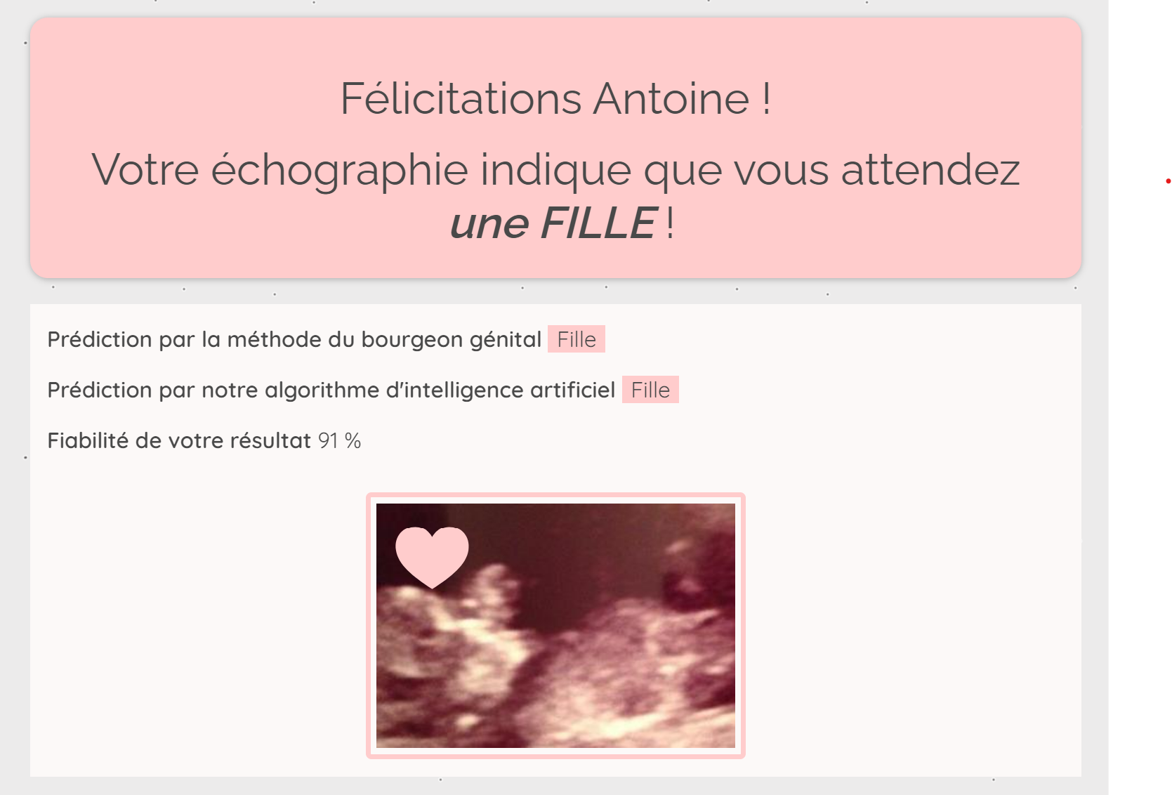 Exemple de résultat Babygram fille